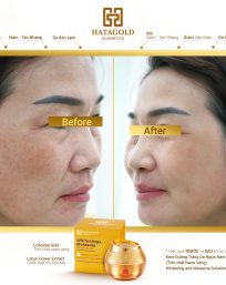 Kem Nám Nhị Sen Tinh Chất Vàng Hatagold Cosmetics - 8936214120017