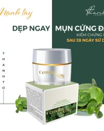 Combo Giảm Mụn Kem Face Rau Má Centella Ance Jiuhe và Serum Acne Extra Jiuhe Thanh Tô Cosmetics - CBJIUHE02